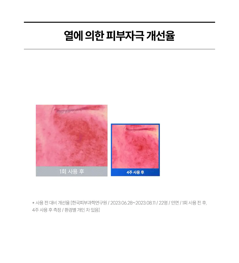 [대용량/속보습폭발] 더랩바이블랑두 올리고 히알루론산 딥 토너 500ml 대용량 기획 (+100ml) 상세페이지 12